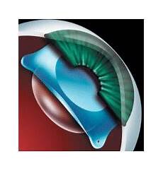 Ophthalmologic Laser