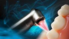 Co2 Laser