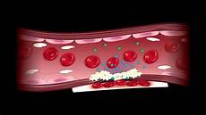 Coagulation
