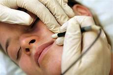 Diode Laser Hair Removal