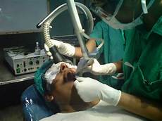 Ent Laser