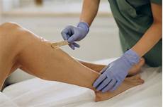 Laser Epilation Devices