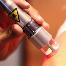 Medical Lasers