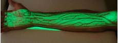 Precision Laser