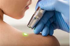 Surgical Laser