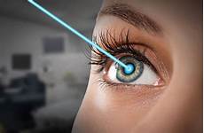Surgical Laser