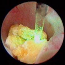 Veterinary Laser